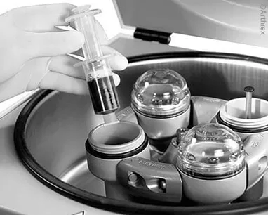 Vampire-Lifiting, Plastische Chirurgie Essen, Schönheitschirurgie Difine, Dr. Mustafa Narwan