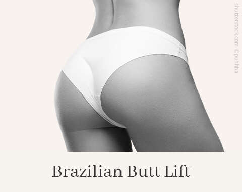 Brazilian Butt Lift, Difine, Dr. Narwan, Plastische Chirurgie Essen 