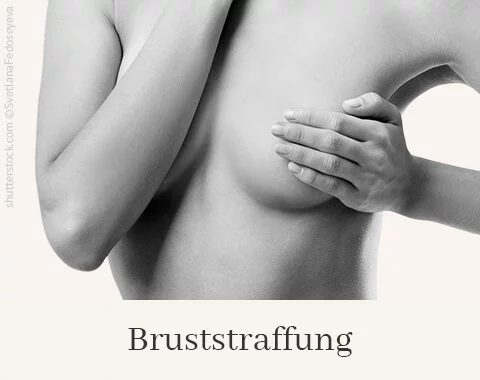 Bruststraffung, Difine, Dr. Narwan, Plastische Chirurgie Essen 