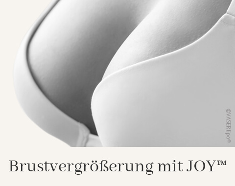 Brustvergrößerung mit JOY, Difine, Dr. Narwan, Plastische Chirurgie Essen 