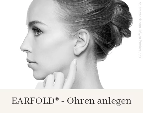 Earfold Ohren anlegen, Difine, Dr. Narwan, Plastische Chirurgie Essen 