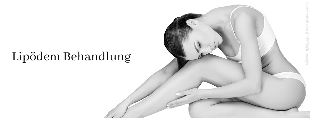Lipödem, Difine, Dr. Narwan, Plastische Chirurgie Essen 