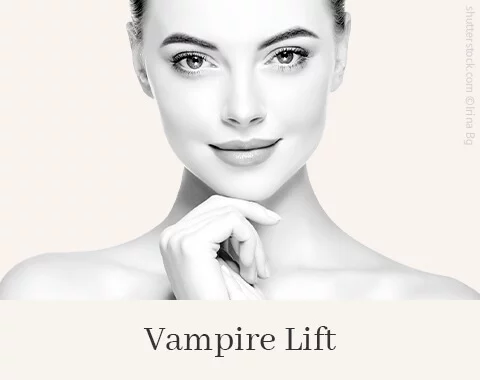 Vampire Lift, Difine, Dr. Narwan, Plastische Chirurgie Essen 