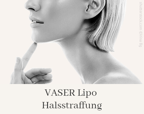 Vaser Lipo Halsstraffung, Difine, Dr. Narwan, Plastische Chirurgie Essen 