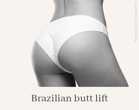 Brazilian Butt Lift, Difine, Dr. Narwan, Plastic Surgery, Essen 