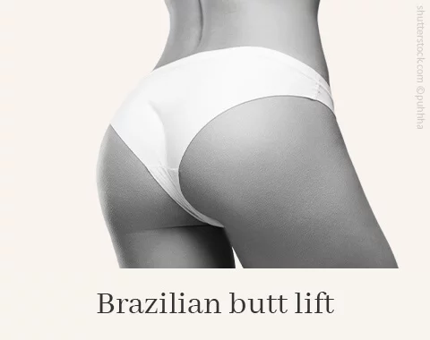 Brazilian Butt Lift, Difine, Dr. Narwan, Plastic Surgery, Essen 