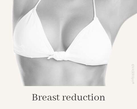 Breast Reduction, Difine, Dr. Narwan, Plastic Surgery, Essen 