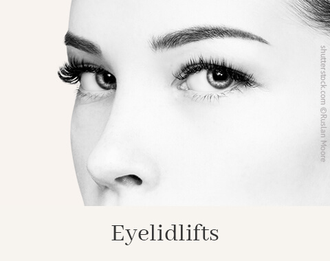 Eyelid Lifts, Difine, Dr. Narwan, Plastic Surgery, Essen 