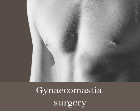 Gynaecomastia, Difine, Dr. Narwan, Plastic Surgery, Essen 