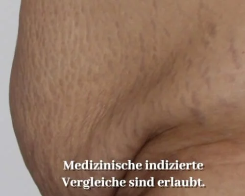 Vorher-Nachher Vergleiche