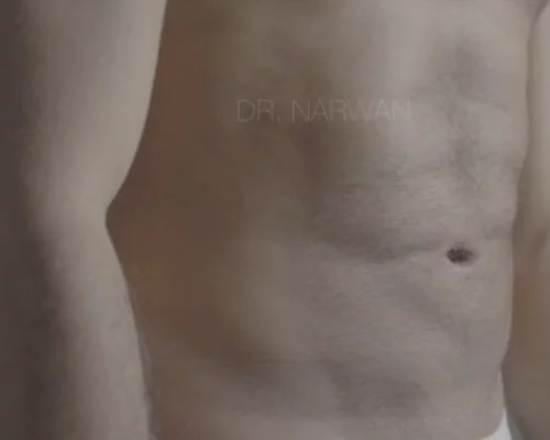 Sixpack, Difine Essen, Plastische und Ästhetische Chirurgie