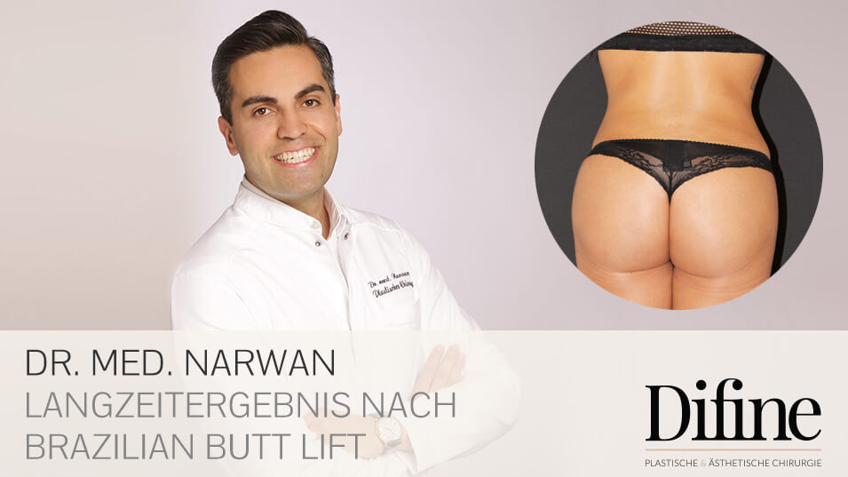 Brazilian Butt Lift, Plastische Chirurgie Essen, Schönheitschirurgie Difine, Dr. Mustafa Narwan