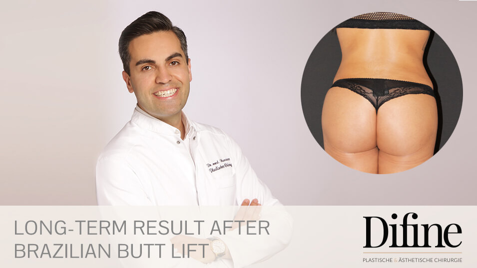 Brazilian Butt Lift, Plastische Chirurgie Essen, Schönheitschirurgie Difine, Dr. Mustafa Narwan