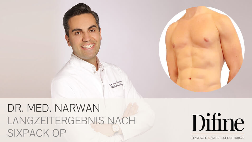 Sixpack OP, Plastische Chirurgie Essen, Schönheitschirurgie Difine, Dr. Mustafa Narwan