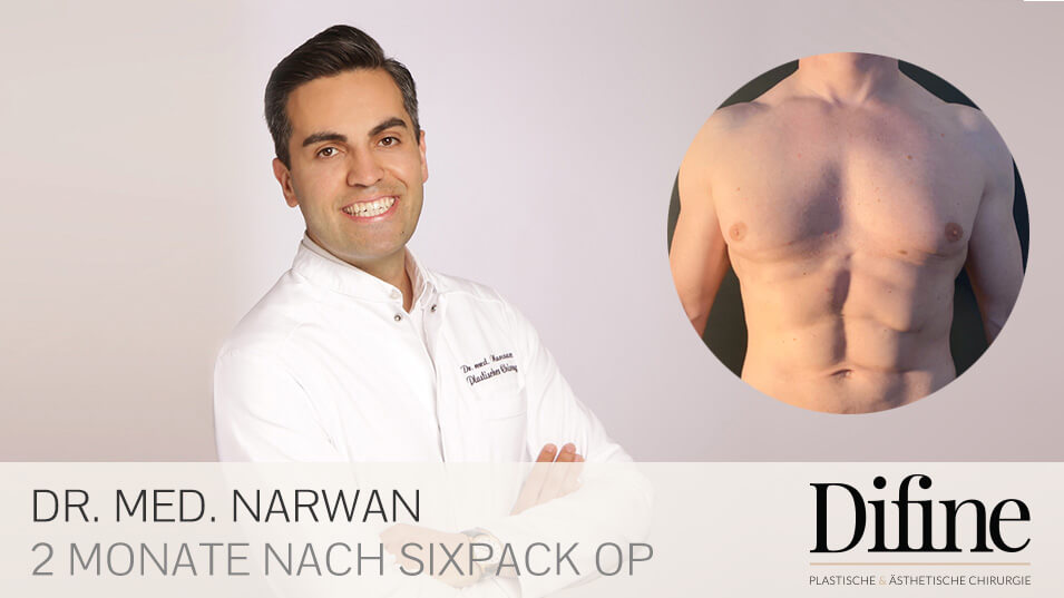 Sixpack OP Ergebnis, Plastische Chirurgie Essen, Schönheitschirurgie Difine, Dr. Mustafa Narwan