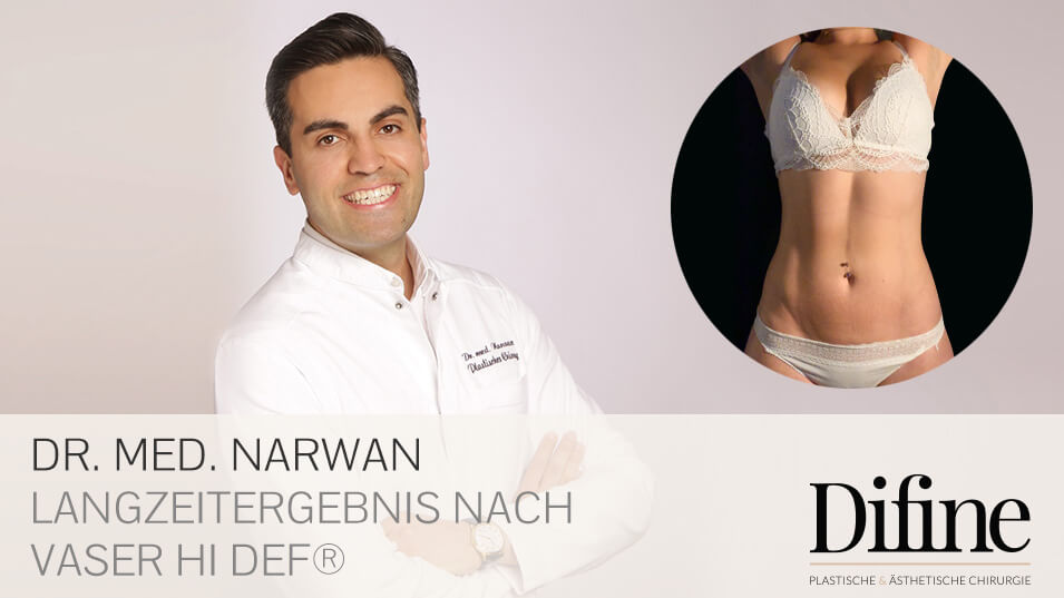 Vaser Hi Def, Plastische Chirurgie Essen, Schönheitschirurgie Difine, Dr. Mustafa Narwan